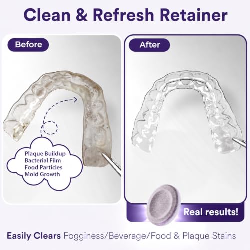 Weiss Naturals Retainer Cleaner Tablets (30 Count)