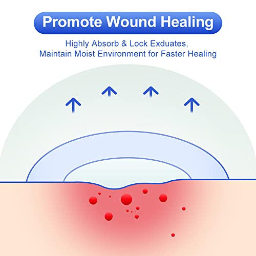 Hydrocolloid Bandages 2" x 4" (10 Count)