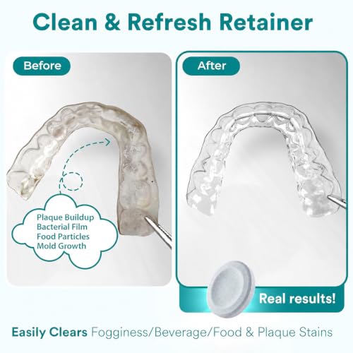 Weiss Naturals Retainer Cleaner Tablets (120 Count)