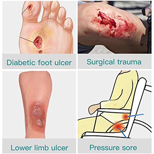 Calcium Alginate Wound Dressing (10 Count)