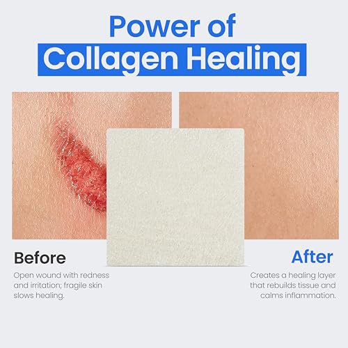 Collagen Pads for Wounds (5 count)