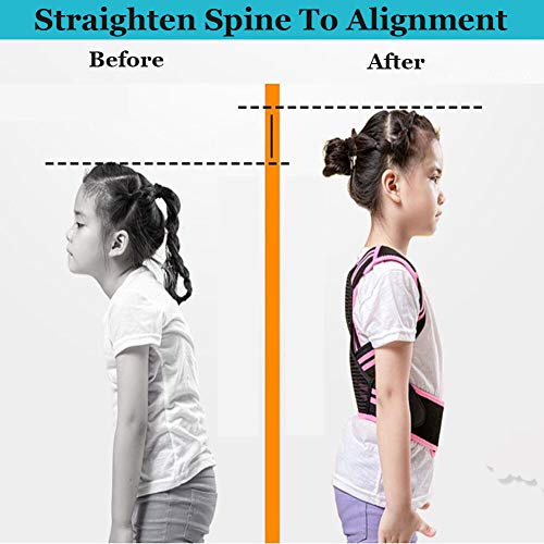 Professional Posture Corrector for Kids