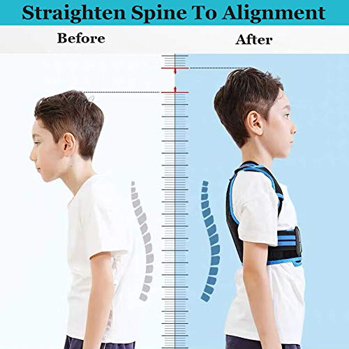Professional Posture Corrector for Men