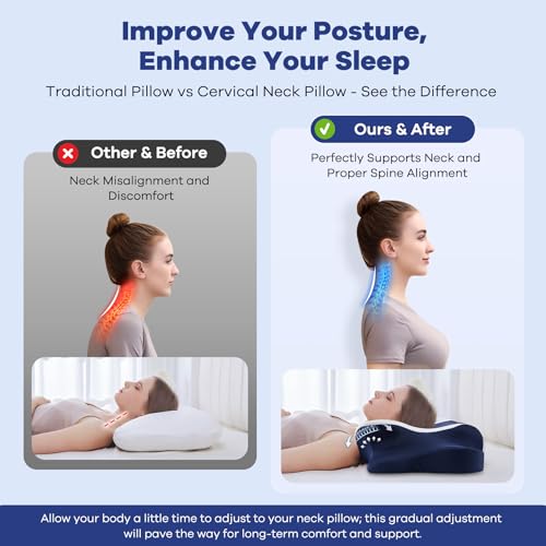 Cervical Pillow for Neck Pain