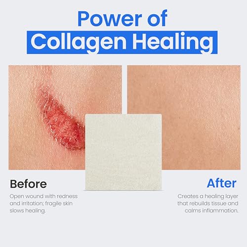 Collagen Dressing Pads (5 Count)