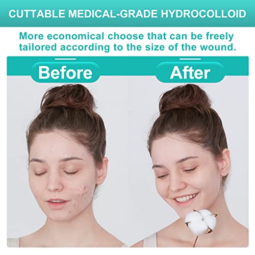 20 Pack Hydrocolloid Wound Dressing (20 Count)