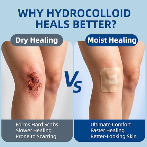 Hydrocolloid Bandages 2"x2" (20 Count)