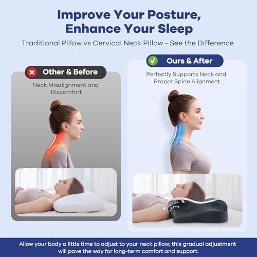 Cervical Pillow for Neck Pain